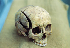 Cranial Injury Study Reveals Huge Violence In Lawless Ancient Middle-Eastern Cities