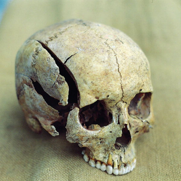 Cranial Injury Study Reveals Huge Violence In Lawless Ancient Middle-Eastern Cities